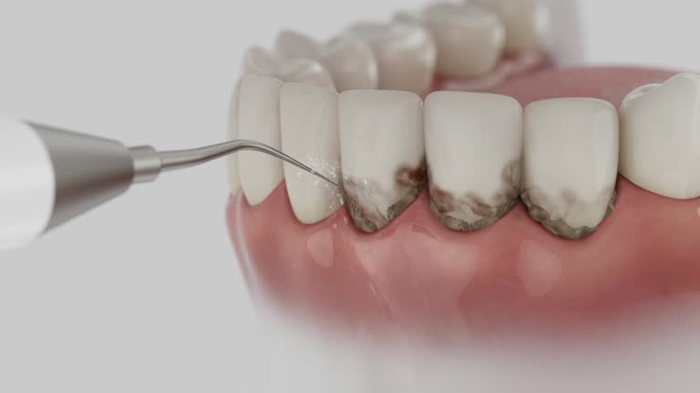 Reliable Dental Implants contractor in Rio, VA by Smile Center Dentistry
